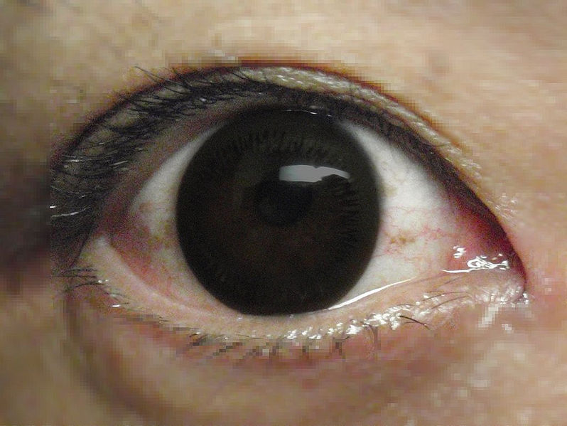 Tiedosto:Iso musta pupilli (piilolinssi, tekaistu).jpg