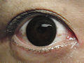 Iso musta pupilli (piilolinssi, tekaistu).jpg